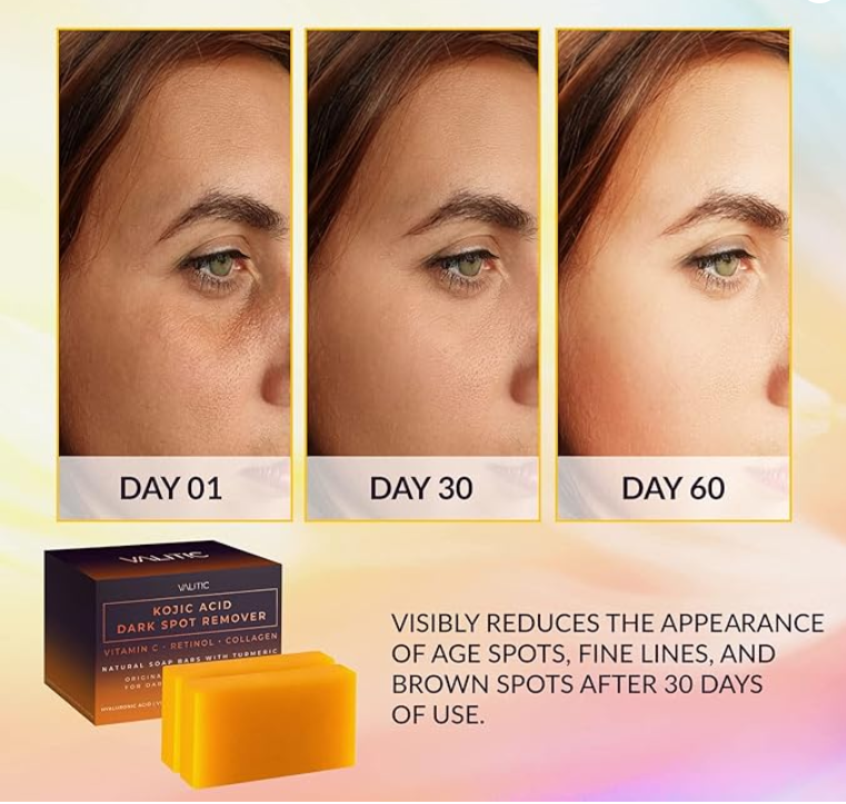 VALITIC Kojic Acid Dark Spot Remover Soap Bars with Vitamin C, Retinol, Collagen, Turmeric - Original Japanese Complex Infused with Hyaluronic Acid, Vitamin E, Shea Butter, Castile Olive Oil (2 Pack)